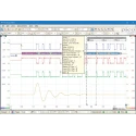Pico Technology 25 MHz PC Based Oscilloscope 16-Channel Mixed Signal with Arbitrary Waveform Generator PicoScope 2205A MSO