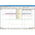 Pico Technology PC Based Oscilloscope 4-Channel 100 MHz Bandwidth PicoScope 2408B